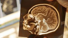 Baby Infant Brain Scan Concept