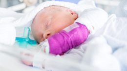 Baby in Intensive Care Methylmalonic Aciduria