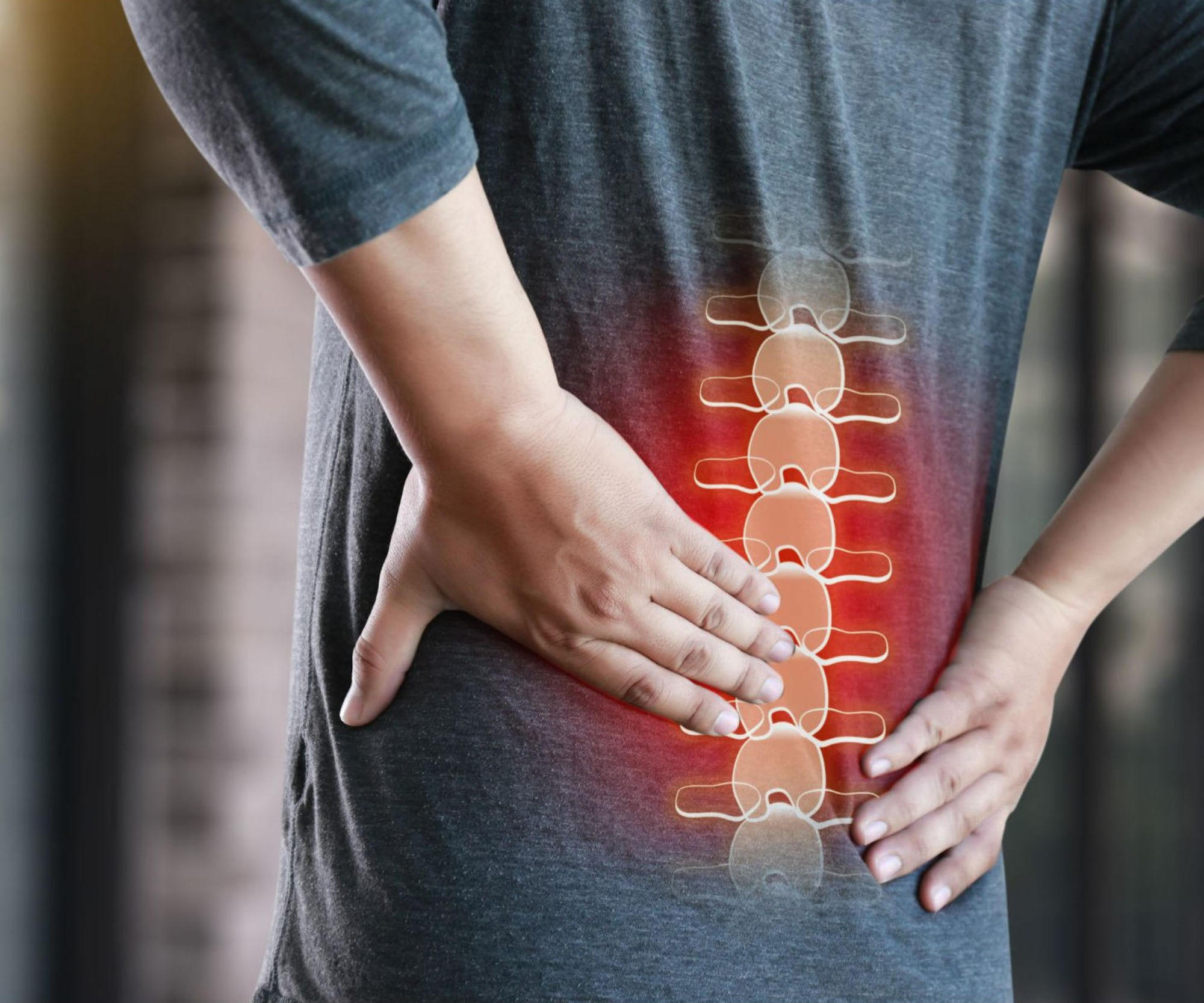 The BMJ: No Evidence Muscle Relaxants Ease Low Back Pain