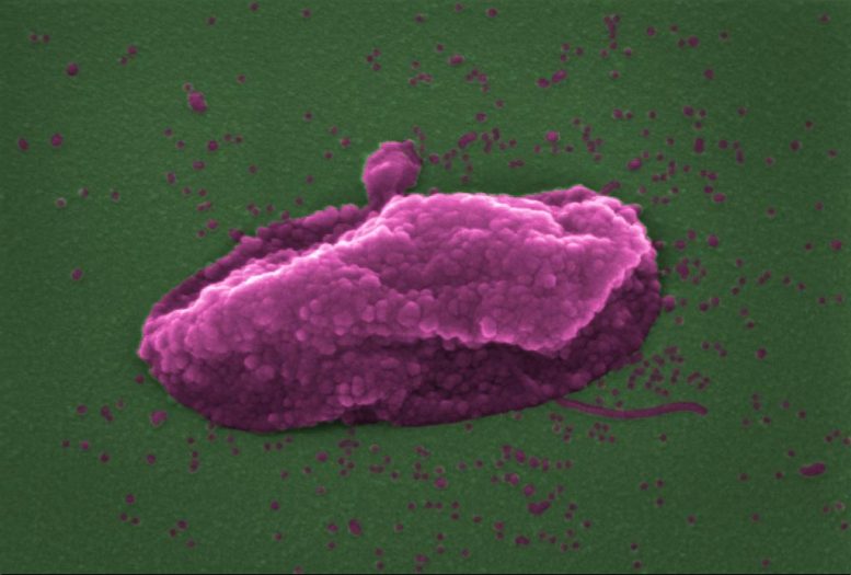 Bacteria ‘Popped’ by Antibiotic