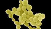 Bacteria That Produce Gold by Digesting Toxic Metals