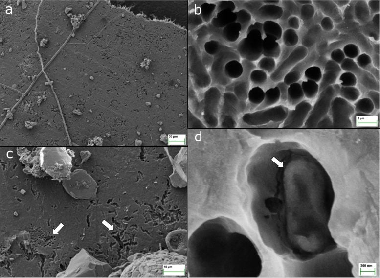 Bacterial Degradation of Plastic Film in Forest Soil