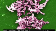 Bacterial Infection C dificile Widespread in the United States