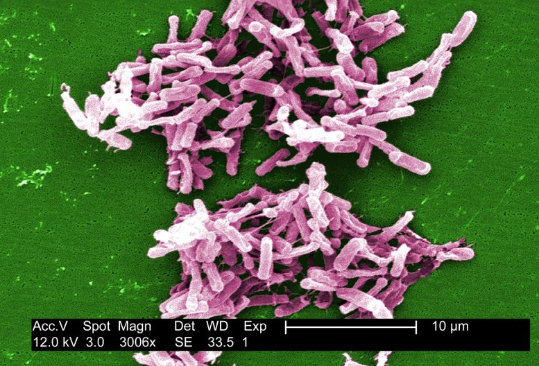 Bacterial Infection C dificile Widespread in the United States