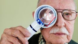 Bad Vision Age Related Macular Degeneration