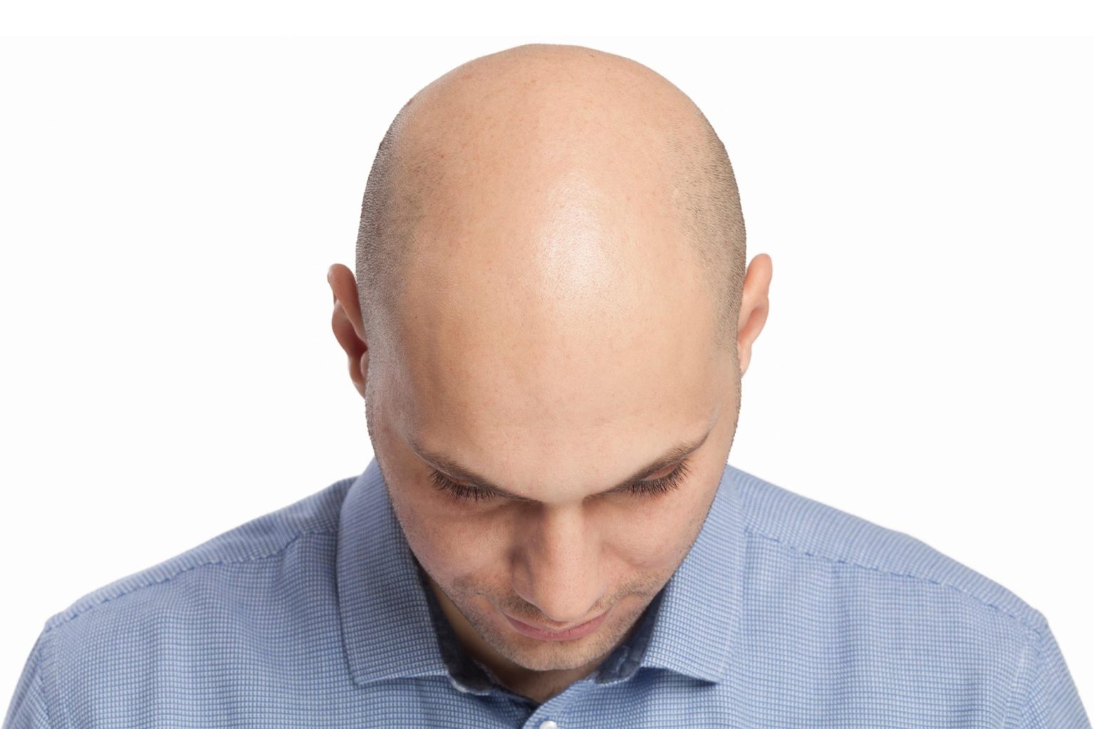 Potential Cure for Baldness Discovery of Chemical Controlling Life and