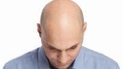 Bald Man Head