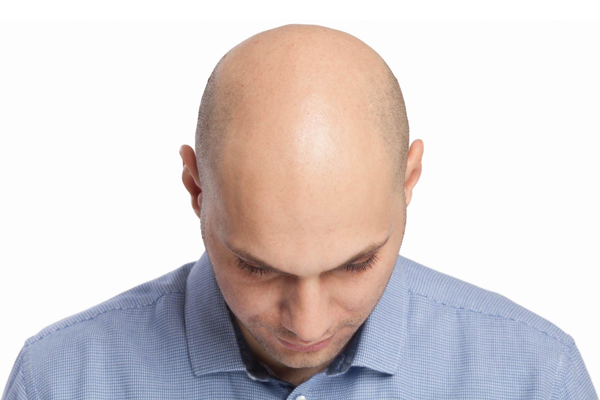 Head of a bald man