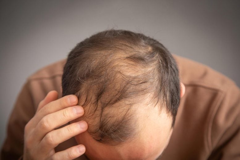 Scientists Discover a “Protector” Protein That Could Help Reverse Hair Loss