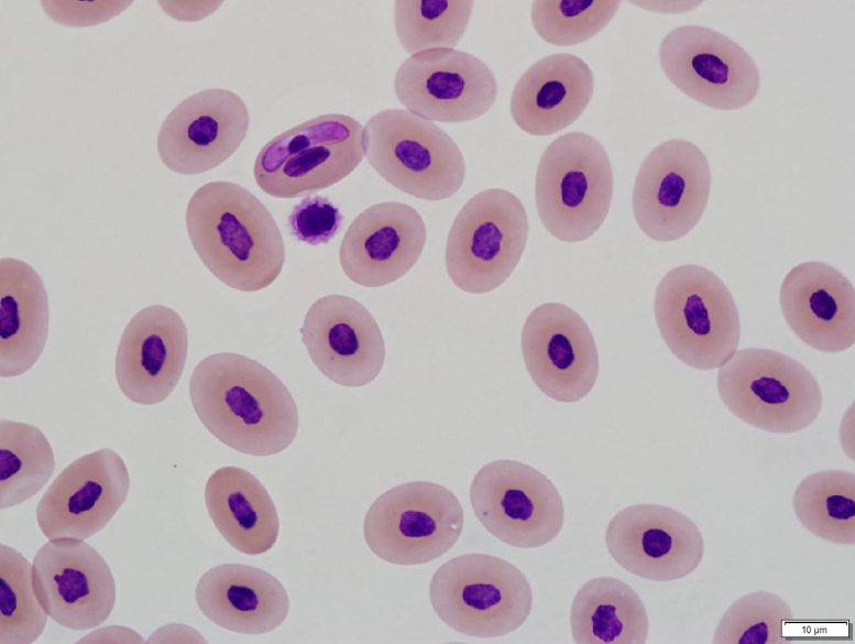 Banded Watersnake Blood With Hepatozoon spp