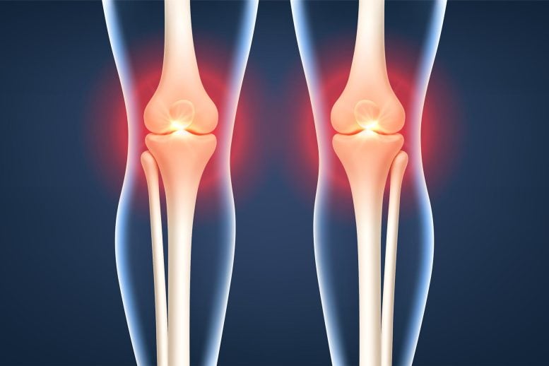 Bilateral Knee Joint Pain Inflammation