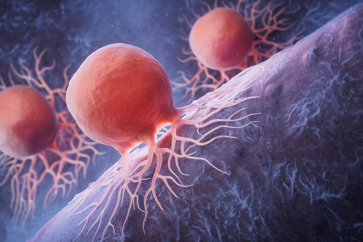 Major Cancer Breakthrough Could Help Patients Who Don’t Respond to ...