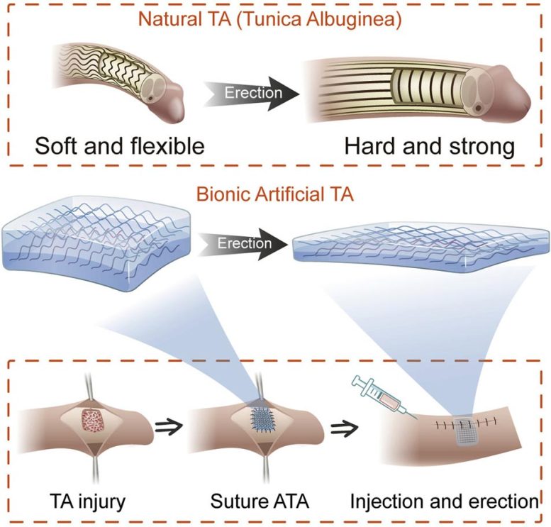 Bionic Artificial Penile Tunica Albuginea