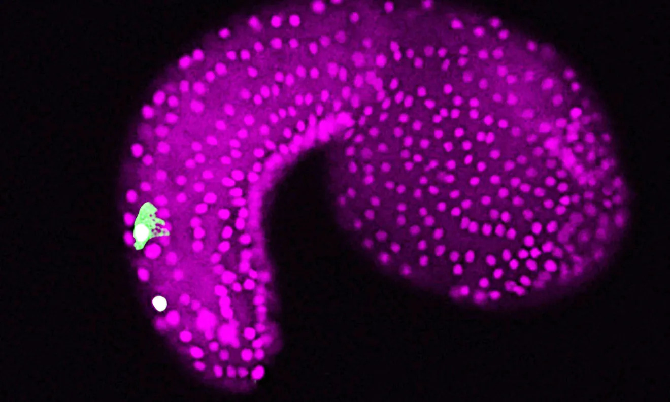 双极尾神经元科学家找到我们感官的遗传起源