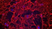 Blocking Matrix-Forming Protein Might Prevent Heart Failure