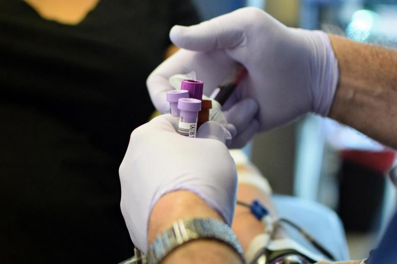 Blood Samples for Heart Disease Research