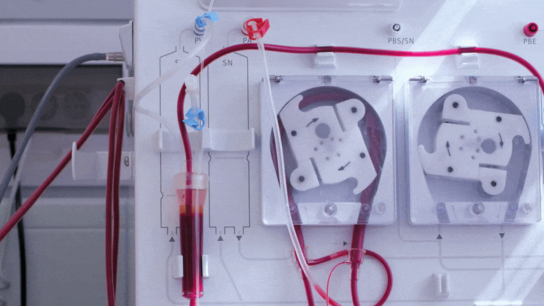 Blood Transfusion Apparatus