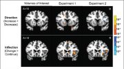 Brain Activity Foreshadows Changes in Stock Prices
