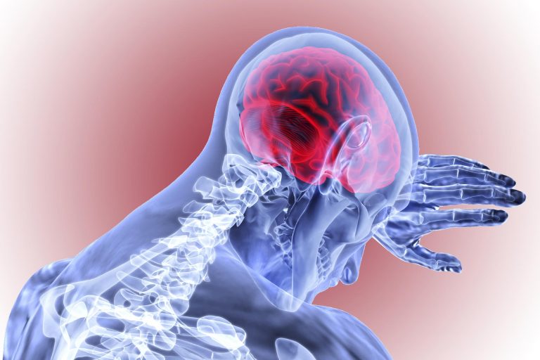 Direct Link Between Smoking and Fatal Brain Bleeding Found in Large