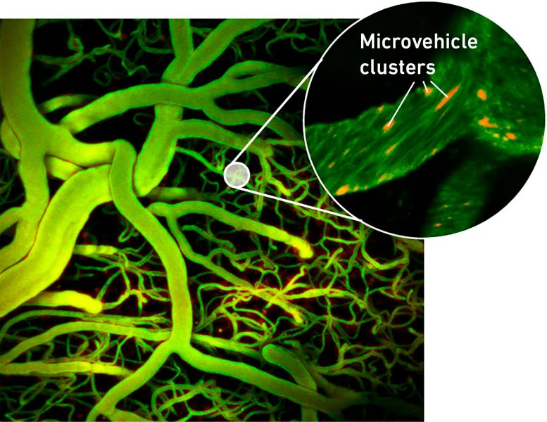 Brain Blood Vessels Microvehicle Clusters