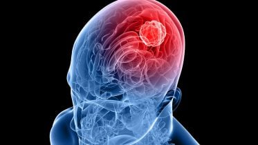After 7 Years of Research, Scientists Have Discovered a New Treatment for Devastating Brain Tumors
