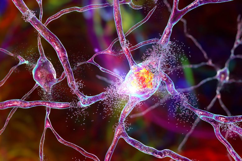 Brain Cells Neuron Destruction Dorsal Striatum