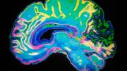 Brain Color MRI Scan