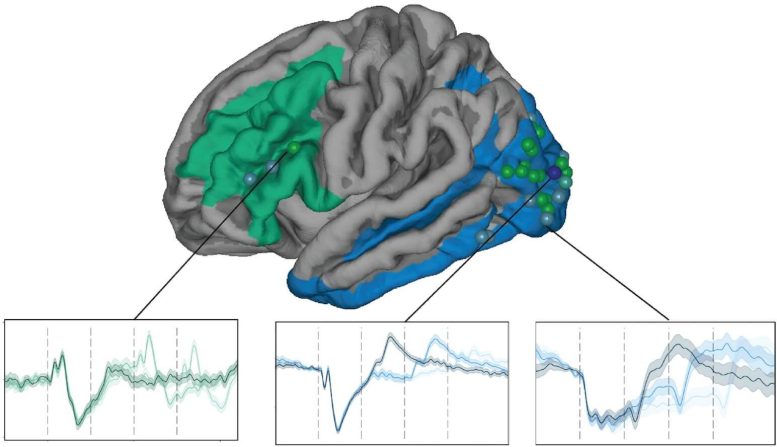 Brain Consciousness LMM on ERP Signal