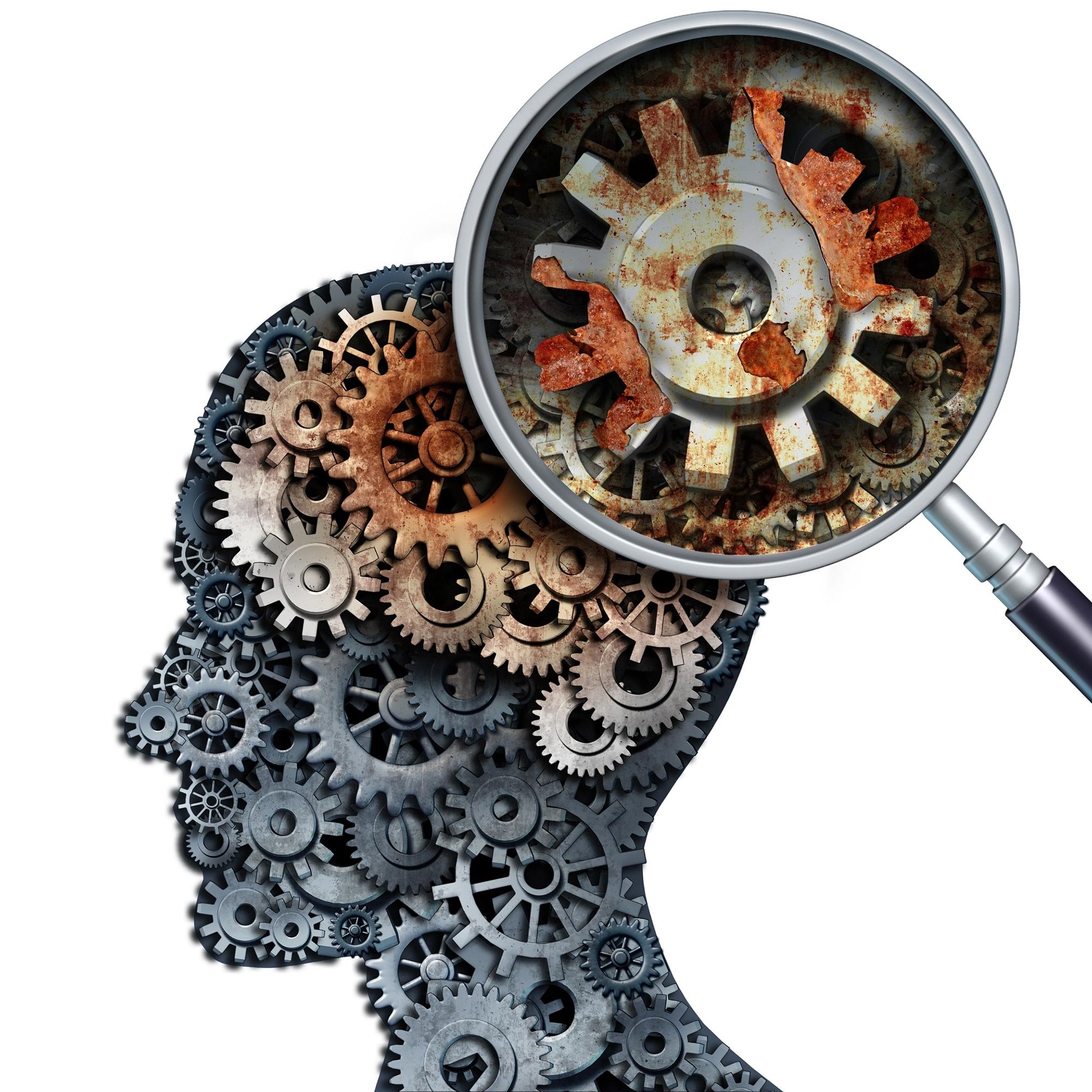 Brain Decline Dementia Analysis Concept