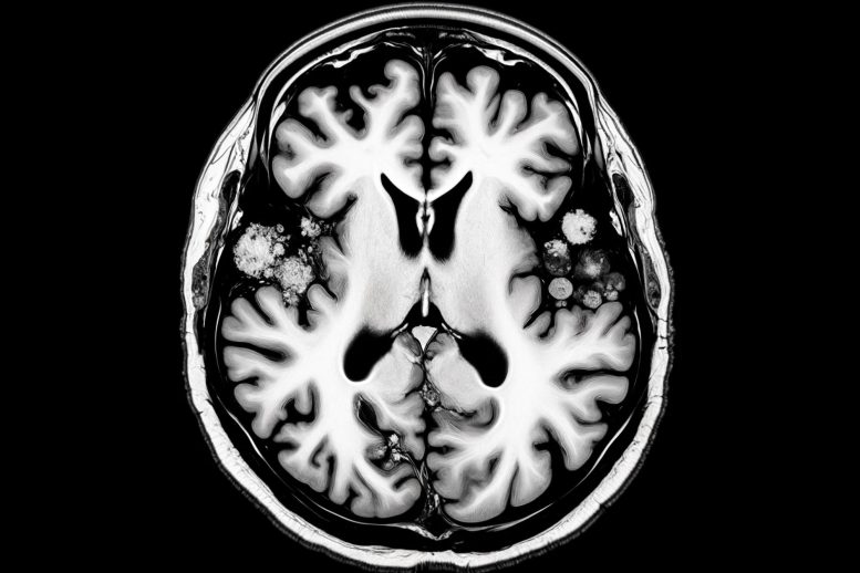Brain Disease Scan Neurological Disorder Art Concept