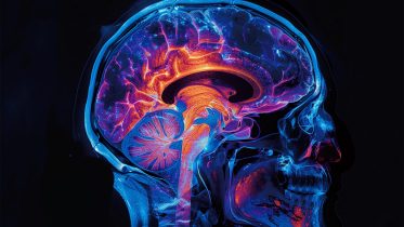 Irreversible Brain Damage: New Threat From Fentanyl Inhalation