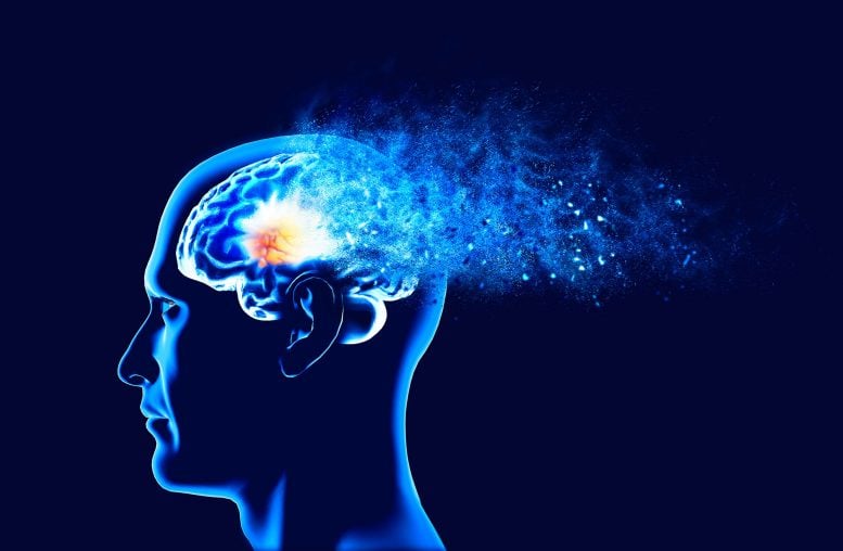 Brain Disintegrating Dementia Alzheimer's