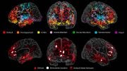 Brain Electrode Map