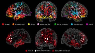 Neuroscientists Have Pinpointed the Origins of Creativity in the Brain