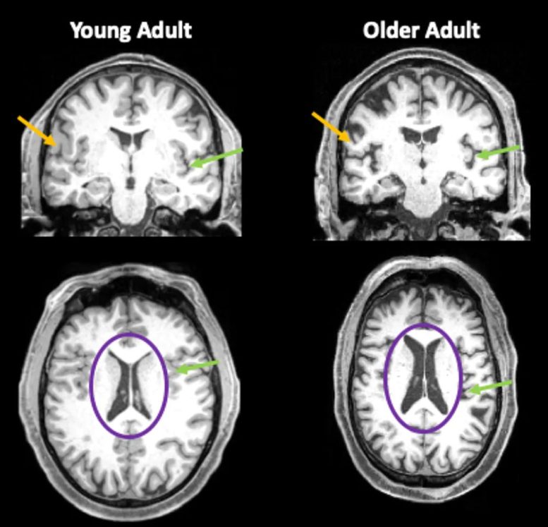 Brain Images Young and Old