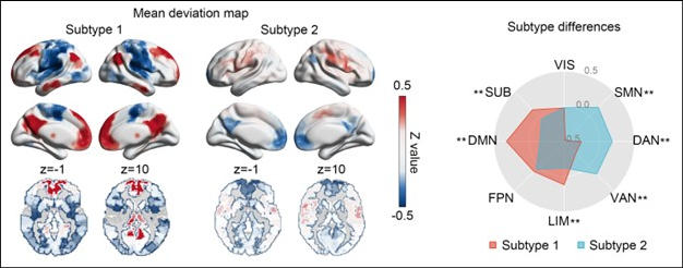 Brain Imaging Based Biomarker of Depression Identified