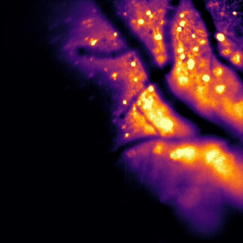 This New Tool Lets Scientists Watch the Brain Think