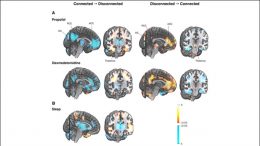 Brain Network Driving Changes in Consciousness