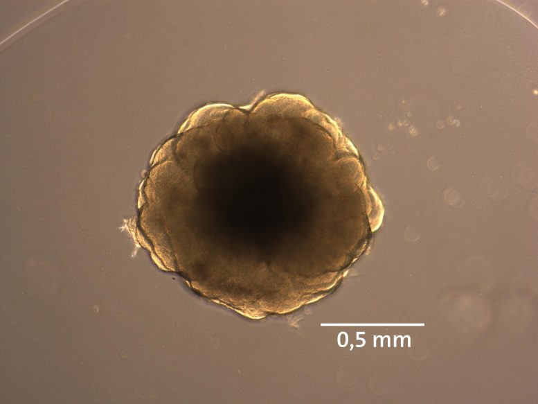 Brain Organoid of a Chimpanzee
