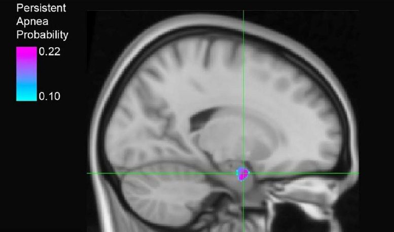 Brain Region Associated With Breathing Failure Following Seizures