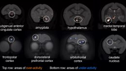Brain Regions Affected by sgACC Over-Activity During Threat