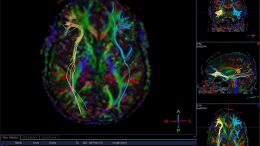 Brain Scan Neuroscience Concept