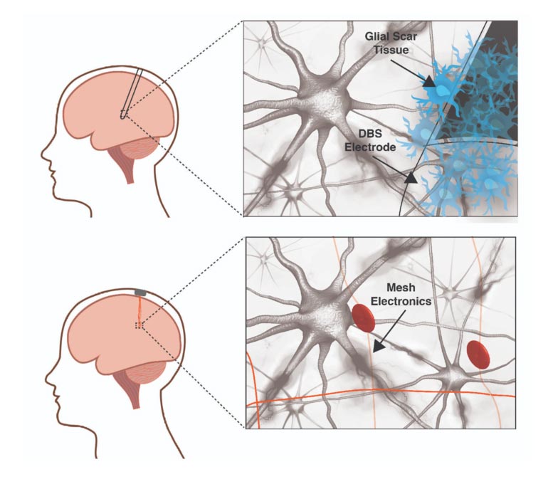 Neural Implants and the Future of Mind Control