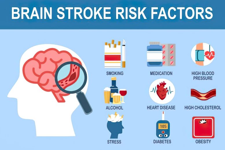 Brain Stroke Risk Factors