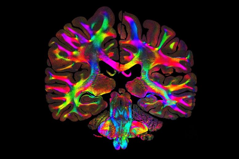 Brain Tissue Microfibers