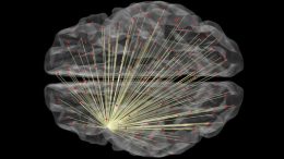 Brain imaging can predict how intelligent you are