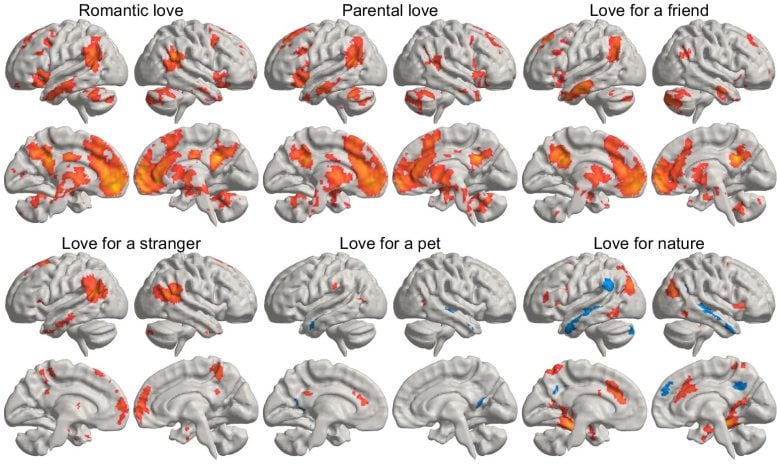 Brain in Love