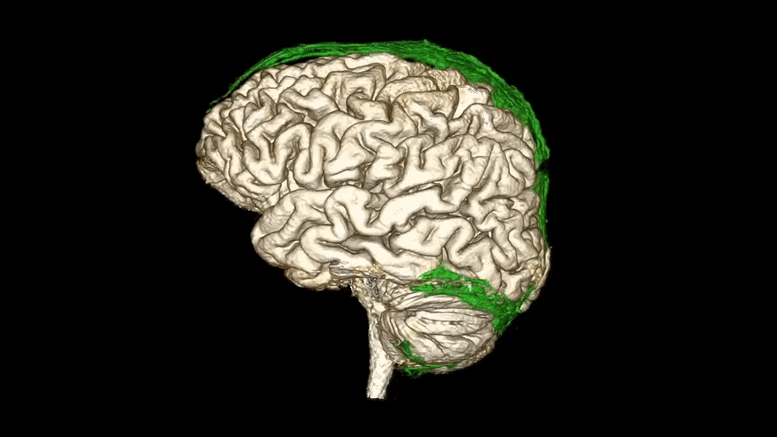 A Near-Real-Time View of the Drains Inside the Human Brain