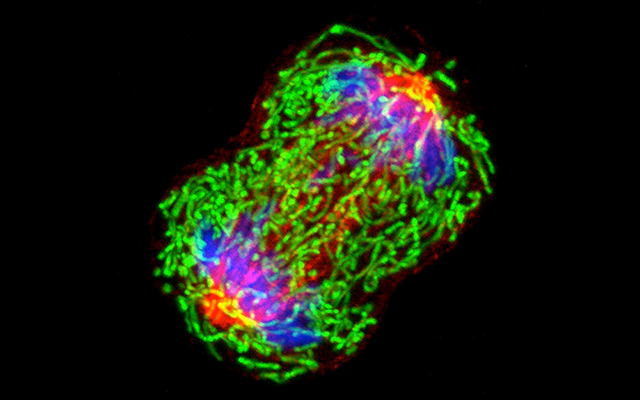 Breast Cancer Cell Division