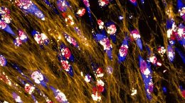Breast Cancer Cells Eating Extracellular Matrix